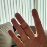 Sunny Instagram - 칭구들한테 물어보니까 올리고 싶은거 다 올리고 얼굴도 올리면 된다길래ㅋㅋㅋㅋㅋ 내 요즘 취미!!!!! 까고 또까기!!😆 도토리도 까고 밤도 까고 더덕도 깐다!!!! 영광의 상처ㅋㅋㅋㅋ 담엔 뭘 또 까볼까🤔😝😝😝😝😝