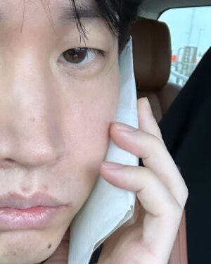 Tablo Instagram - 어금니 치료 받고 얼음찜질 하라고 해서 이러고 돌아다니는데 사람들이 날 알아보고 다가오다가 “아 통화중이네” 하고 뒤돌아서서 감 #아이폰15프로맥스