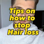 Twan Kuyper Instagram - Tips on how to stop hair loss Tag a friend