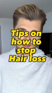 Twan Kuyper Instagram - Tips on how to stop hair loss Tag a friend