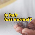 Twan Kuyper Instagram - Is hair loss normal?