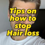 Twan Kuyper Instagram - Tips on how to stop hair loss