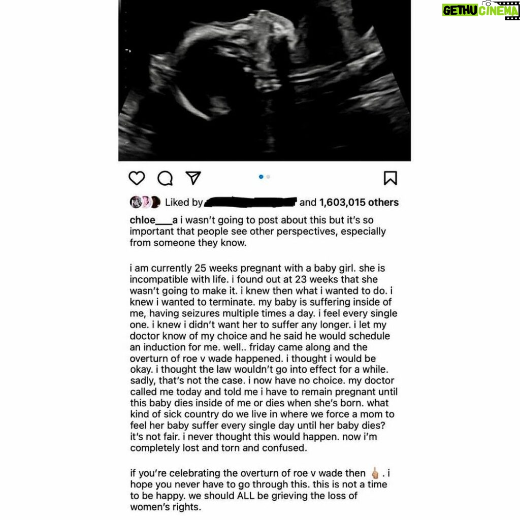 Tyler Baltierra Instagram - This is absolutely heartbreaking to me! It’s only been a week since overturning Roe V Wade & look at the unnecessary trauma it’s causing already! The bottom line is that the decision to choose if abortion is the right choice for anyone, should be between THEM & A DOCTOR of their choice! NOT some theocratic hypocritical dishonest judges! I wonder what the judges who voted in favor of overturning Roe V Wade would tell this poor woman? You know, the same ones who LIED in the confirmation hearings about their opinions on that case in order to get their power? Yeah those ones! I feel so sad for this woman & the inevitable others that will have to face this type of unnecessary adversity in the future due to the Supreme Court’s attack on women’s reproductive rights. To all the women out there & as a father of all girls, I promise you I will fight to the end for you to have your reproductive rights! I stand with you & I’m just so sorry that we even have to fight this in the first place 😔💔