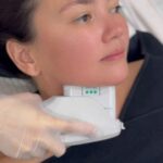Angelica Panganiban Instagram - Join @iamangelicap as she elevates her beauty game with her annual Aivee Ulthera Maxx Lift! This time, she’s targeting that double chin for a snatched, contoured jawline that’s truly envy-worthy! 💫 ✅ AIVEE ULTHERA MAXX LIFT is a facial lifting and skin tightening procedure that uses ultrasound to boost the production of collagen and elastin that gives the skin a noticeable lift and tightness. DISCLAIMER: Treatments and procedures depend upon consultation. We highly encourage our patients to be examined by our doctors for us to prescribe the proper treatments for your skin and body concern. Treatment costs may be discussed upon consultation. Book your appointment now by calling or sending us a message here! +639177283838 - Local Hotline +639614514572 - International Hotline +639692230499 - Whatsapp/Viber Or you may call our branches at: 📍 A-INSTITUTE, BGC: +63917 521 0222 📍 FORT, BGC: +63920 966 5529 📍 MEGAMALL: +63917 871 9500 📍VERTIS NORTH: +63917 164 4170 📍 ALABANG: +63917 537 4200 #aivee #theaiveeclinic #aiveeclinic #aiveeday #aiveelove #aiveeleague #draivee #drzteo #aiveeultheramaxxlift