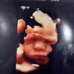 Hillary Vanderosieren Instagram - Est ce que le petit frère de Milo ressemblera à Milo ? Swipe .. et dis moi ce que tu en penses 😱 Perso, je trouve que c’est des copies conformes 😂