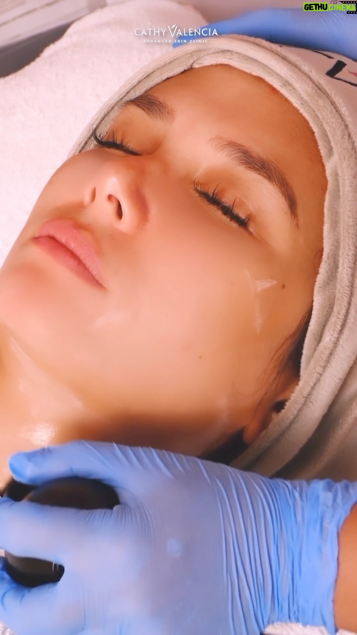 Isabel Oli Instagram - Got some stubborn fat on your face? We have the solution for it! Melt & contour your face & give yourself that sought after V-line with the CV WINBACK TRIOSLIM! 🌟 @isabeloliprats ‘s choice for that lifted & contoured face! 🌟 A non-surgical procedure that instantly lifts, tightens, and sculpts loose skin. It regenerates the dermis by acting right down to the deepest layers. This treatment stimulates fibroblasts and encourages the production of collagen and elastin, making them look firmer. It may also treat stretch marks, loose or sagging skin, and textured skin. Benefits of the CV Winback Trioslim: 🍃 Your skin is plumped and regains its natural radiance and glow. 🍃 Stimulates fibroblasts and encourages the production of collagen and elastin, making it look firmer. With little to no downtime, you can go on with your daily errands right after treatment! DM us for more information or visit any of our CV Branches below 📩 •Alabang: +63961 829 3461 •BGC Premier: +63917 591 0481 •Makati: +63917 772 0026 •Timog: +63917 772 0029 •Whiteplains: +63917 772 0028 #CathyValencia #CathyValenciaSkinClinic