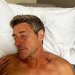 Jason Nash Instagram - Make sure to check your moles and wear your sunscreen. Los Angeles, California