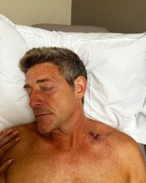 Jason Nash Instagram - Make sure to check your moles and wear your sunscreen.
