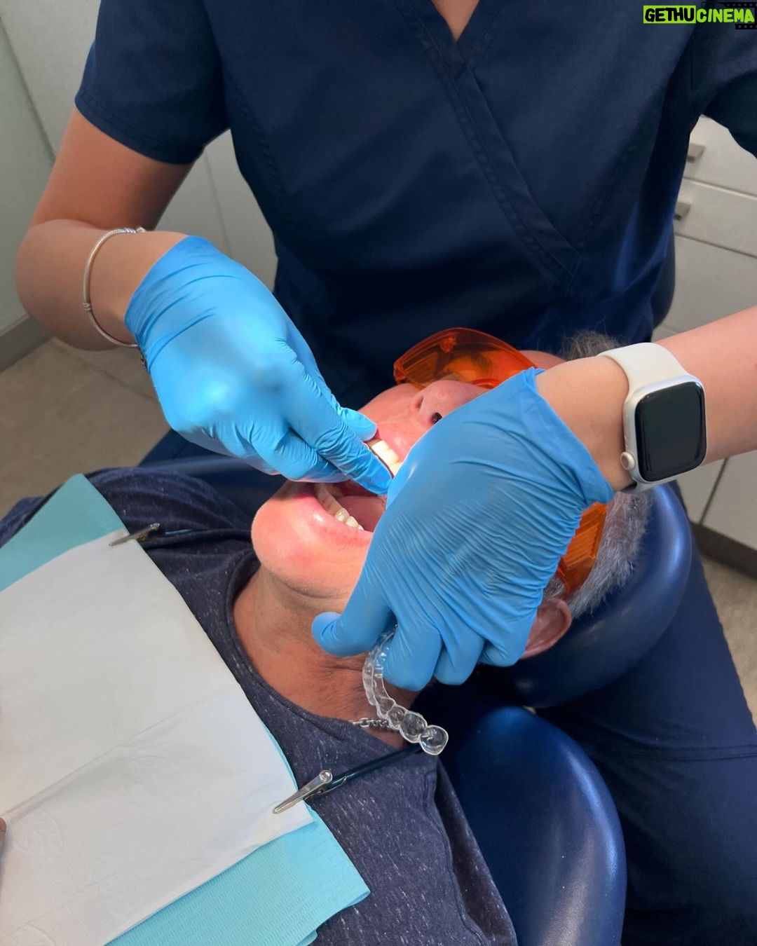 José Miguel Viñuela Instagram - Me queda poquito!! Solo 4 alineadores y termino!! Si y por fin mis dientes derechos! Un sueño hecho realidad! Tu también puedes tener tus frenillos invisibles con @invisaldent y además ahora te regalan un bono de 100.000 pesos para q partas tu tratamiento! Metete a www.invisaldent.com Tel: +56 9 9964 3373 Te esperamos!!!