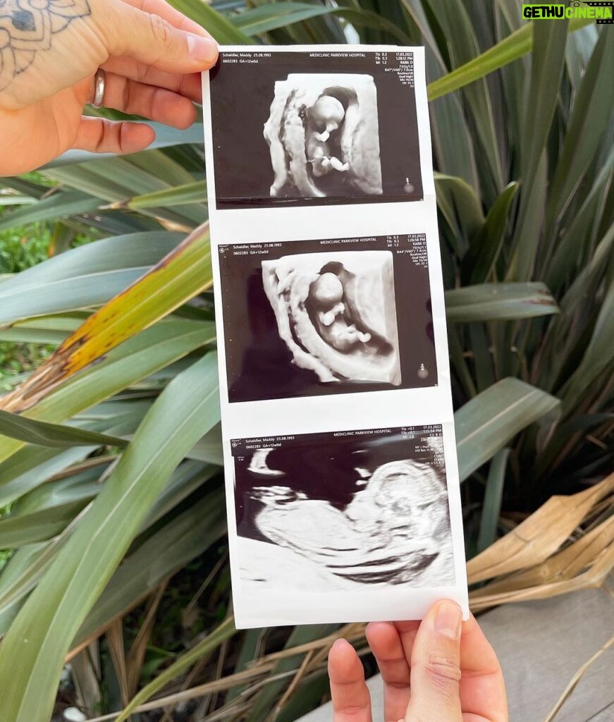 Maddy Burciaga Instagram - BABY SAMAT is Coming ❤️🤰🏼 Nous sommes heureux de vous annoncer que nous serons bientot 3 🥺👶🏻 Nos Rêves se realisent un peu plus chaque jour… Je T’aime plus que tout et j’ai tellement hâte qu’on devienne futur Papa & Maman 🥰 #babyiscoming #pregnant #14sa
