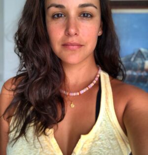 Melissa Fumero Instagram - I have so many mosquito bites.