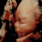 Michelle Renaud Instagram - Estar embarazada es muy bonito… pero alrededor de ellos es mágico ❤️🤰🏻