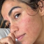 Nanda Costa Instagram – Cadê a galera 35+ daqui?
Tmb tá sentindo na pele o colágeno se esvaindo? Esse ano eu faço 3.8. Vai cair, não tem jeiito. Mas tô trazendo pro feed o meu puro suco de colágeno! Laser pra pele grudar na cara, lazer pra manchas, poros, linhas finas, aff.. . As vezes tem que piorar pra melhorar. 😂
Depois eu posto uma foto de como ficou, se quiserem saber, também conto o que eu fiz ❤️