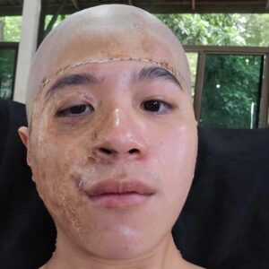 Rathavit Kijworalak Instagram - พี่นาค 4 ( 2024 ) 👻
ขั้นตอนการเข้าสู่ตัวละครติณ
และการเริ่มต้นอดอาหาร เพราะ
ลวดดามปาก กินอะไรบ่ดั้ยยยย
หลอดหยอดน้ำเข้าปากวิธีเดียว
แค่นี้ไม่เห็นภาพต้องไปดู พี่นาค 4
ที่โรงภาพยนต์ !!