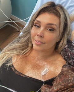 Simony Instagram - Hoje graças a Deus retomo meu tratamento. Como vocês sabem tive uma toxidade nos rins e por isso fui obrigada a parar com a imuno. Hoje é dia de agradecer a Deus mais uma vez por me permitir estar aqui e poder seguir com meu tratamento, que ainda tem mais 2 anos pela frente . Quero deixar minha gratidão ao meu médico @drfernandomaluf sempre muito cuidadoso, a @dra.francinneteixeira a minha nefrologista @ledalotaif que foi muito maravilhosa comigo, @hcor minha segunda e ela a enfermeira que eu amo @danieleteche casa. Eu sou só gratidão sempre. Meus filhos, meu marido, minha mãe, minha família e vocês que de longe me dão tanto amor. Vamos em frente UM DIA DE CADA VEZ Eu posso Eu acredito Eu consigo ❤️🙏 Obs continuo zerada vou repetir os exames em fevereiro 🙏
