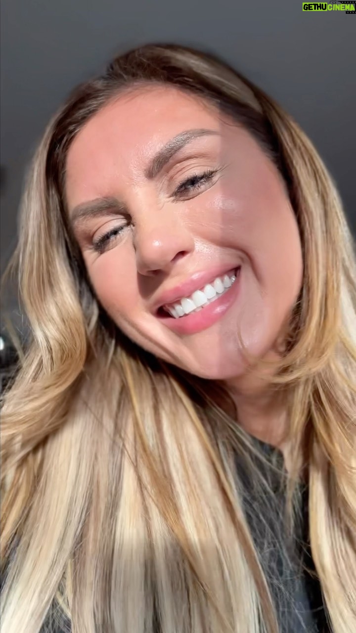 Sophie Hall Instagram - This break that happened to my leg is a pretty rare and serious break, also considered a “career ender” for athletes. I always do my best to take things head on, but when I sit here and think that the average person takes 3 months to be able to properly walk again from this break my mind is blown. I’m so grateful for the support and love that I have, that I’m still able to have so many great reasons to laugh and smile. I don’t know what my lesson here is, but I know with every triumph there is an even greater testimony 💗 #plateautibialfracture #brokenleg #highspirits #faith #strong