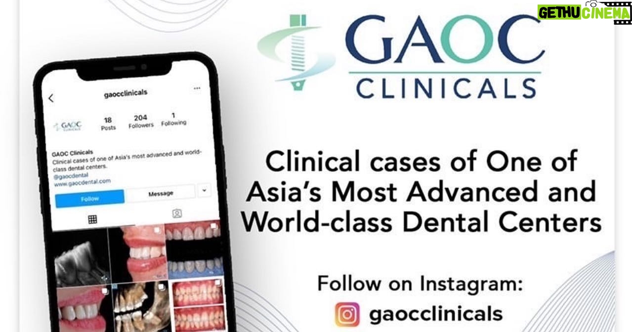 Julia Montes - 97.1K Likes - SMILE .......speaking of smile 😁 We are thrilled to inform you that GAOC launched a new Instagram account called @gaocclinicals they will showcase their vast array of clinical cases for public education and information.