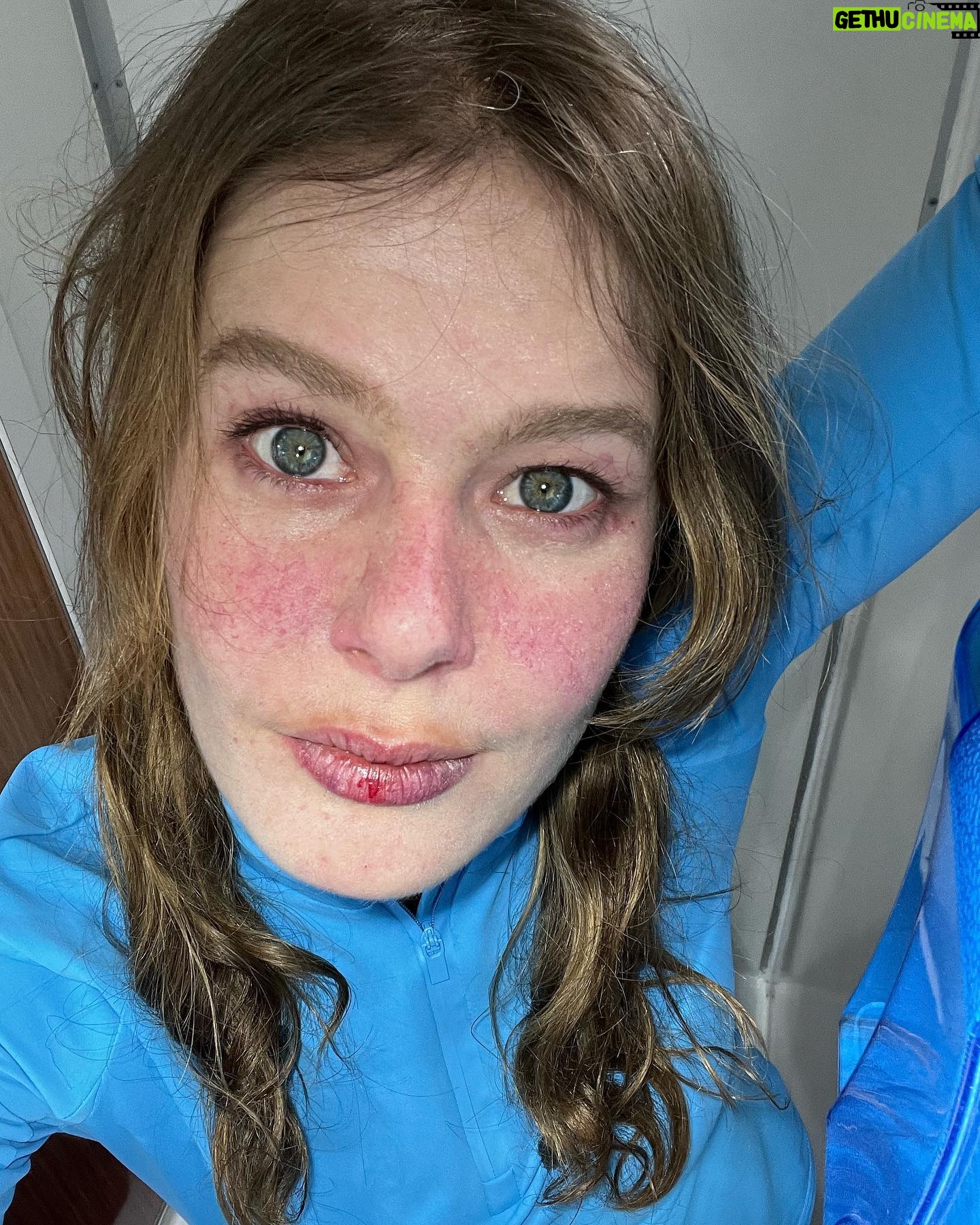 Burcu Biricik - 239.6K Likes - Δ°Εimi Γ§oook seviyorummπ€π€ΈββοΈβ¨
@kiehlsturkiye yakΔ±nda β¦. π«
.
.
#iΕbirliΔi