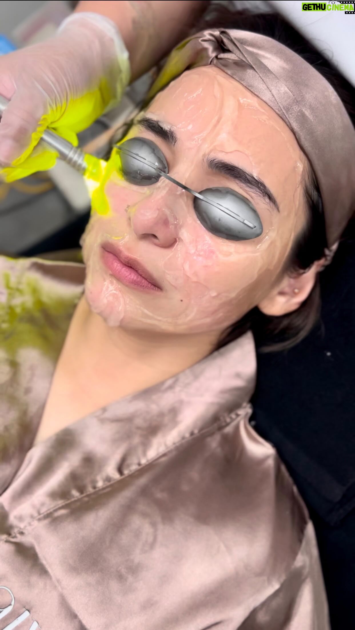 Jennylyn Mercado Instagram - @mercadojenny is taking some time for herself to relax and rejuvenate at @theaiveeclinic #AiveeDay
AIVEE SHINING BRIGHT - deeply penetrate the skin without damaging the tissues to specifically target various types of skin pigmentation issues such as age spots, discoloration from acne and melasma
AIVEE JET INFUSION - uses a high-pressure stream of oxygen and a customized serum to deeply cleanse, exfoliate, hydrate, and nourish the skin. It can also address skin problems such as sunburn, skin dehydration, acne, and dry skin
AIVEE TEMPSURE - helps reveal the natural contours and definition of her arms by dissolving stubborn, excess fats making it look slimmer, tighter, and contoured
Treat the most important woman in your life by bringing them at @theaiveeclinic and get 10% OFF ON ALL SINGLE TREATMENTS! β¨
Terms and conditions apply.
Book your appointment now by calling or sending us a message here!
639177283838 - Local Hotline
639614514572 - International Hotline
639692230499 - Whatsapp/Viber
Or you may call our branches at:
π A-INSTITUTE, BGC: 63917 521 0222
π FORT, BGC: 63920 966 5529
π MEGAMALL: 63917 871 9500
πVERTIS NORTH: 63917 164 4170
π ALABANG: 63917 537 4200
#aivee #theaiveeclinic #aiveeclinic #aiveeday #aiveelove #aiveeleaugue #hydratedskin #moisturizedskin #glowingskin #brighterskin #lighterskin #draivee #drzteo #jennylyn #jennylynmercado #reels #igreels #deals #treatformom