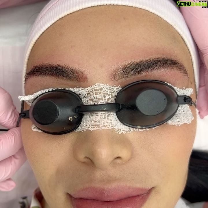 Aline Mineiro Instagram - Depois de muito tempo eu tomei coragem! 😱
Um carrossel diferenciado e cheio de vídeos pra mostrar o início do processo da remoção da pigmentação das minhas sobrancelhas com a @nataliabeauty ☺️
Não é fácil e também um pouquinho doloroso, mas vale a pena 🙌🏼
E você, também tem vontade de desfazer esse processo? Se SIM, Espero servir de inspiração ♥️