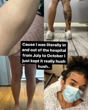 Aja Instagram - Last time I’m posting because I am half way to my goal and am not interested in making it a thing 💛 thank you for your positivity 🫶🏽

Written by my daughter Davina: @hyperbolethequeen 

Hello All,

Ajá/Venus is a performance artist, runway model, spiritual leader and NY native. For over 10 years she has worked as an entertainer and her sustainability has relied on her body. Recently, she has had to spend time in and out of hospitals due to leg swelling and various other injuries. With expenses piling and being unable to perform as frequently, she’s switched to a part time day job and doing spiritual readings for some income. However this alone has not been enough to dig her out of the financial hole hospital visits and bills create. 

This woman does so much for many communities - LGBTQ folk, people wanting to explore and seek spiritual guidance, the ballroom community and more. She has opened her heart, her home and mind to guide, entertain and help so many people. Now she needs help and although she’s a public figure with these enormous talents life is not perfect for anyone. 

Attached below are ways to donate to her, please share this as much as possible and hopefully we can get her to a good place until she’s back up to 100% again.

Venmo: @ajanyc
PayPal/zelle: ajathekween@gmail.com
Cash app: $ajaibukole

PS (from Venus) I was in and out the hospital for 3 months straight and the medical people told me little to nothing, I am still dealing with really bad leg pain and what not which is why I have not been dancing or voguing much. I’ve been walking runway as a form of exercise still but sometimes I do feel pain still. I’m hoping to get answers soon but in all, the medical expenses and the travel to and from has been crazy on me as I am not working as much. Recently I have taken on a day job to rehabilitate my legs and keep things going however the debt from being in the hospital multiple times and seeing multiple specialists has been insane. I’m hoping my day job helps lighten the load as well. Any help is appreciated. Just trying to get back on track! I know I may seem like I’m living this life because social media but social media is not real life 🫶🏽