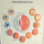 Alexey A. Petrukhin Instagram – ГЛАЗА — САМЫЙ ВАЖНЫЙ ОРГАН чувств человека, с помощью зрения мы получаем 90% информации из окружающего нас мира. При этом это уникальный по структуре и еще не до конца изведанный орган человека. Посмотрите вторую и третью фотографии и Вы увидите целую Вселенную, #космос 👌 Но на сегодняшний день #ученые открыли множество его тайн, а профессиональные #медики проводят операции невообразимой сложности. Хочу выразить огромную благодарность Московской Глазной Клинике @mgk_clinic 👈 за диагностику и лечение моей Мамы @babtoma (фотоотчет у неё на странице) 📸 Доверил врачам #МГК самое дорогое и не прогадал… Доктор Адам Дагаев оперативно подготовил Маму к операции, сотрудники клиники помогли оперативно сдать все анализы и тесты. Так мы не упустили время и сделали операцию в кратчайшие сроки 👌 Сейчас зрение Мамы улучшилось, неприятных ощущений больше нет, готовимся к следующим процедурам!
Всем #советую #проверено и #рекомендую не тянуть с обследованием, если Вас хоть что-то беспокоит 🙄  На 6-ой фотографии, которую я сделал в Клинике, видны разные виды #болезниглаз 🤦‍♂️ Надеюсь никто не найдёт у себя этих признаков 🤞 И кстати, люди, собаки и кошки – единственные, кто ищут зрительные подсказки в глазах других ☝️ а собаки делают это только, общаясь с людьми 🐕 . 
И ЕЩЁ, ДЛЯ ВАС, Други, всем, кто придёт в 👉 @mgk_clinic с паролем #режиссёр, скидка 20% на все виды обследования, а кто придёт с паролем #кинопродюсер скидка 21% 🥁 Будьте здоровы, и смотрите на мир здоровыми глазами 🙏 . 
#глаза #лечениеглаз #глазнаяклиника #здоровье #21 #АлексейПетрухин Московская Глазная Клиника ” Мгк”