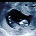 Amanda Nunes Instagram - We can’t wait to see your little face, Hazel Ann Nunes. 👩‍👩‍👧‍👧