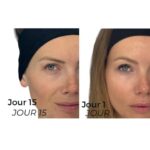 Amandine Petit Instagram - ma routine skincare anti-pigment en collaboration commerciale avec Eucerin 🫧🦋🧖🏼 Sur mon nez, sous mes yeux et autour de ma bouche j’ai des taches brunes qui me donnent l’air fatiguée quand je ne suis pas maquillée, et qui sont devenues avec le temps, un complexe. Avec @eucerin_fr j’ai décidé de suivre la routine anti-pigment avec le sérum et la crème pendant 2 mois pour réduire les taches pigmentaires que j’ai sur le visage. En 2 semaines, les résultats sont déjà très satisfaisant ! 🙏🏼🥰#EucerinCaMarche #AntiTaches