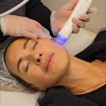 Angélica Castro Instagram - Nada como estimular la producción de colágeno de la piel con una de las mejores tecnologías disponibles en el mercado ✨️ El VIRTUE RF asocia el microneedling y la radiofrecuencia logrando apretar la piel, mejorar el tono, la textura, la apariencia de cicatrices, y reducir líneas finas y arrugas. El tratamiento personalizado para @angelicacastro_ va a ser hecho en 3 sesiones, 1x por mes, finalizando cada sesión con un boost de ácido hialuronico y vitaminas, aprovechando que los canales de la dermis están abiertos debido al microagujamiento. Felices de cuidar de ti, Angelica. Nos vemos en la próxima sesión 🥰