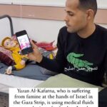 Annie Lennox Instagram - Dear Friends… This is a VERY HARD message to share, but I feel it’s essential to stay aware of what STARVATION as a weapon of destruction actually looks like. This precious young boy is Yazan Al Kafarna, who was forcibly displaced from Gaza to the city of Rafah. He is on the verge of death, due to lack of food and oxygen in hospitals and health care. As a result of the Israel Gaza conflict, the entire health care system has now totally collapsed.. @savegazaschildren is an NGO dedicated to supporting the children of Gaza with life saving emergency medical care. Please go to their website and do whatever you can to support their lifesaving work. #ceasefire #stopthegenocide