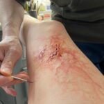 Ashley Johnson Instagram - Bellie. Bite progression tests. Anna.
