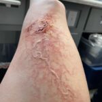 Ashley Johnson Instagram - Bellie. Bite progression tests. Anna.