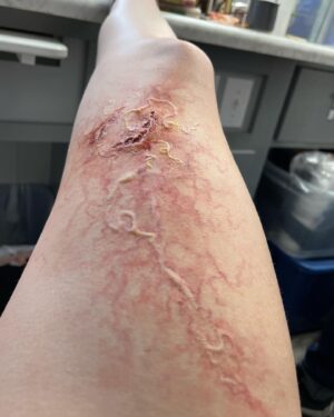 Ashley Johnson Instagram - Bellie. Bite progression tests. Anna.