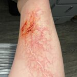 Ashley Johnson Instagram - Bellie. Bite progression tests. Anna.
