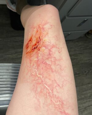 Ashley Johnson Instagram - Bellie. Bite progression tests. Anna.