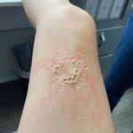 Ashley Johnson Instagram - Bellie. Bite progression tests. Anna.