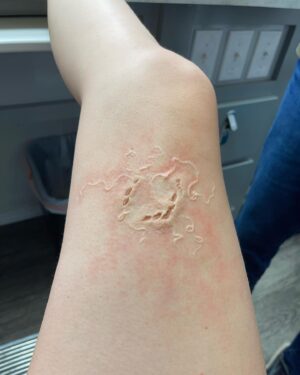 Ashley Johnson Instagram - Bellie. Bite progression tests. Anna.