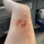 Ashley Johnson Instagram - Bellie. Bite progression tests. Anna.