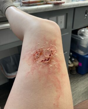 Ashley Johnson Instagram - Bellie. Bite progression tests. Anna.