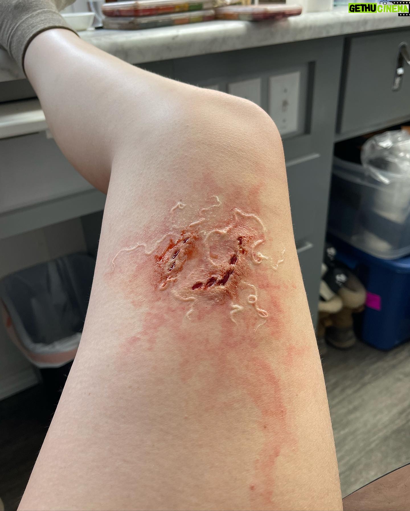 Ashley Johnson - 409.3K Likes - Bellie. Bite progression tests. Anna.