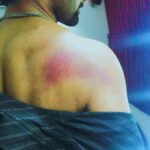 Atharvaa Instagram - Need to learn how not to get injured during a fight sequence . 💪 #whenshitgetreal