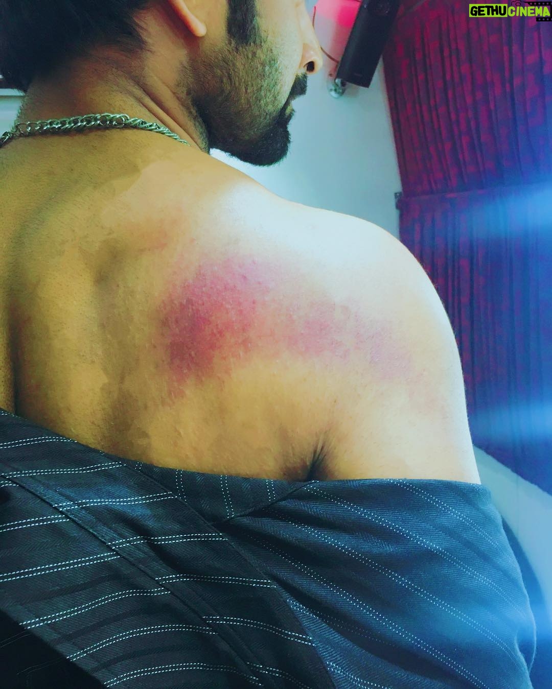 Atharvaa Instagram - Need to learn how not to get injured during a fight sequence . 💪 #whenshitgetreal