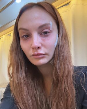 Başak Gümülcinelioğlu Instagram - After > Before. Biri bugün bölüm izlemeye hazırlanan, diğeri dün sahne çekmeye hazırlanan, ben. İkisi de ben ❤️ Akşama bölüm var, benimle misiniz dostlarım 🫶🏻 
@kulmasalitrt
