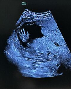 Caity Lotz Instagram - Gaining weight for the role of a lifetime 🤰🏼🥰 👋