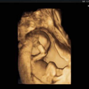 Capucine Anav Instagram - A ce moment précis j’étais enceinte de 5 mois et j’étais à j-2 de vous l’annoncer 😍😍 … Ma grossesse était incroyable et j’étais frustrée de devoir vous le cacher pendant 5 mois, mais j’étais obligée pour protéger ma grossesse ! A l’époque j’avais mis cette photo en story en coupant mon ventre … maintenant je la poste entièrement 😍😍😍🫶🏼🫶🏼🫶🏼