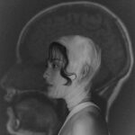 Chanya McClory Instagram – Me and my first MRI film when I discovered the brainstem tumor.

Four years ago today was the day I first discovered it. After one surgery, it got smaller, but it continue to grow with me every day. However, as long as it hasn’t decided to let me go, I will keep going on my path!

Shoutout to all the strong women followers on this #internationalwomensday Don’t let anything stop you from pursuing your dreams :)

Thank you to everyone who was a part of this personal shoot. Miss you all! @thenapat_photographer @brizzlechizzle @sup.sneak @_kilbill