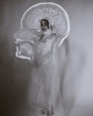 Chanya McClory Instagram - Me and my first MRI film when I discovered the brainstem tumor.

Four years ago today was the day I first discovered it. After one surgery, it got smaller, but it continue to grow with me every day. However, as long as it hasn’t decided to let me go, I will keep going on my path!

Shoutout to all the strong women followers on this #internationalwomensday Don’t let anything stop you from pursuing your dreams :)

Thank you to everyone who was a part of this personal shoot. Miss you all! @thenapat_photographer @brizzlechizzle @sup.sneak @_kilbill