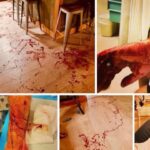 Chelsea Peretti Instagram - WARNING!!!‼️ BEAR ATTACK AFTERMATH IMAGE SECOND SLIDE ‼️LETS JUST SAY DONT GET BIT BY A BEAR @clennertzmusic thank you for sharing your tale! 💩💩❤️ @callchelseaperetti #bear #bearattack #bearattacks #bearattacksurvivor #naturelovers