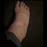 Chris Pratt Instagram – Mercy filming day 4. I have such a great stunt team! AND I sometimes try to get in there and do some of my own stuff. Today, daddy caught a metal post to the ankle. Should be interesting moving forward. 🧐