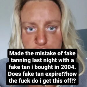 Daisy May Cooper Instagram - Please help. The fake tan i used is 20 years old? No fake tan remover is working and lemon juice is not working. Tried nail varnish remover and that just burns